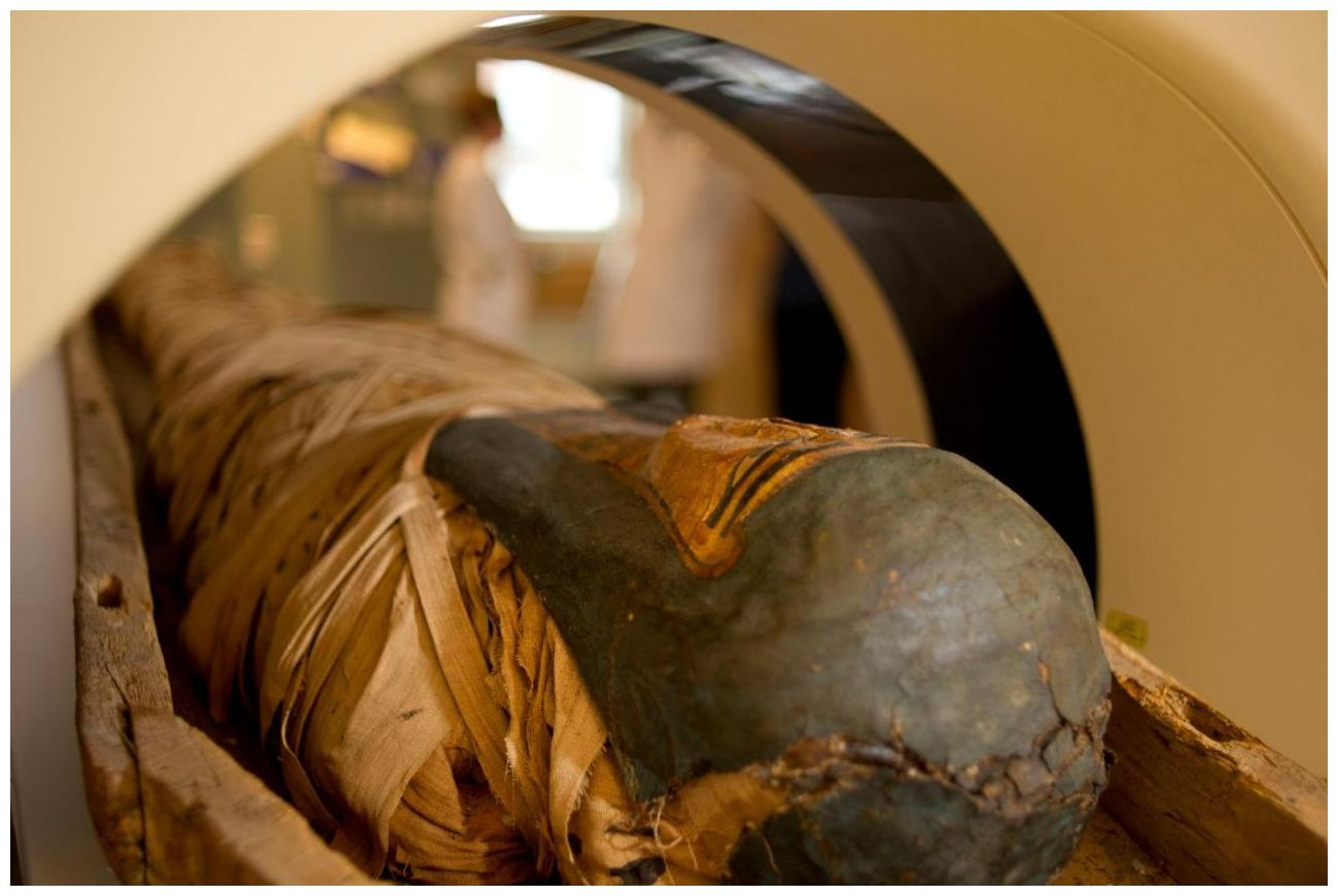 Ancient Egyptian Mummy's 'Screaming' Expression Solved by CT Scans