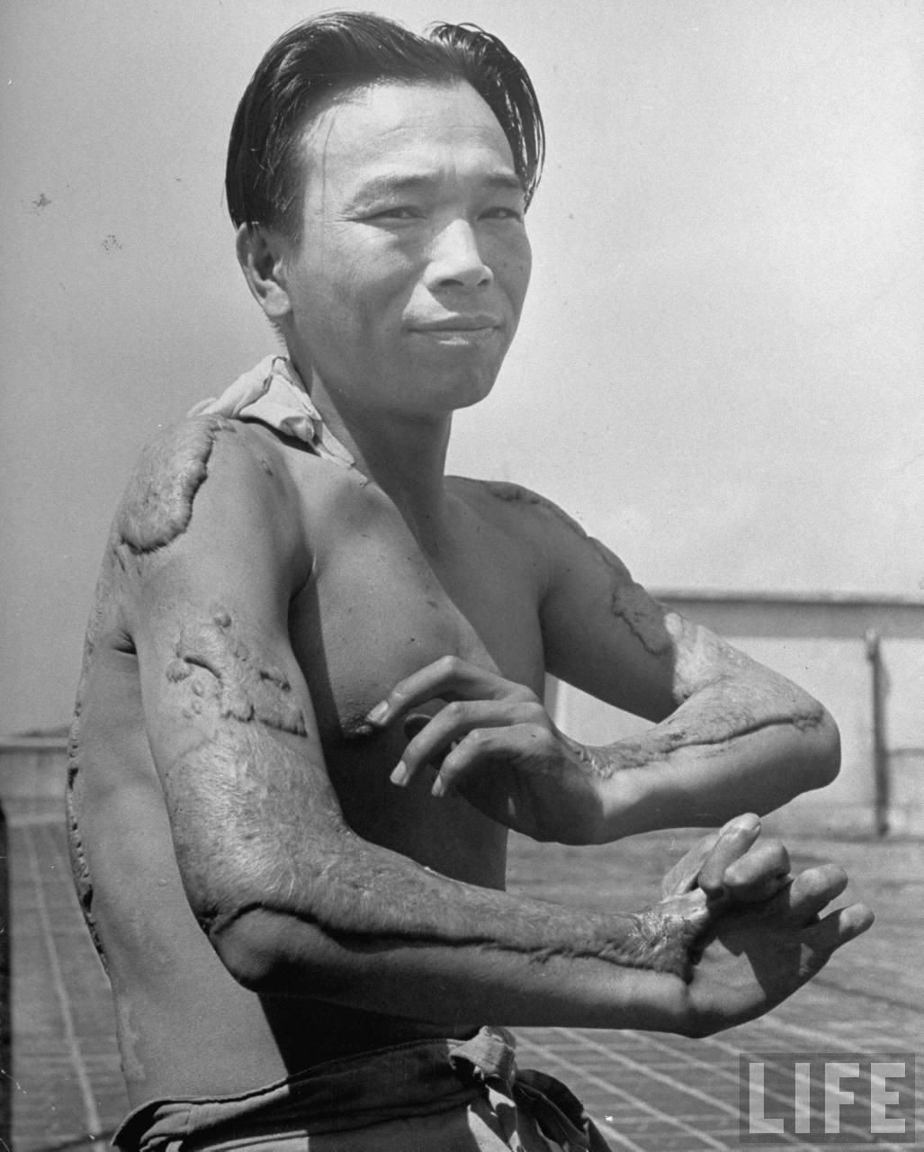 Atomic People: The Horrifying Reality of Hiroshima and Nagasaki's Survivors