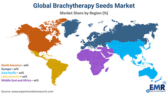 Brachytherapy Market: A Booming Industry Driven by Technological Advancements and Growing Demand