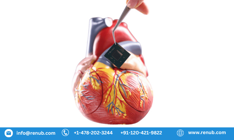 Cardiac Bio Implant Devices Market to Reach US$ 69.12 Billion by 2032:  Aging Population and Technological Advancements Drive Growth