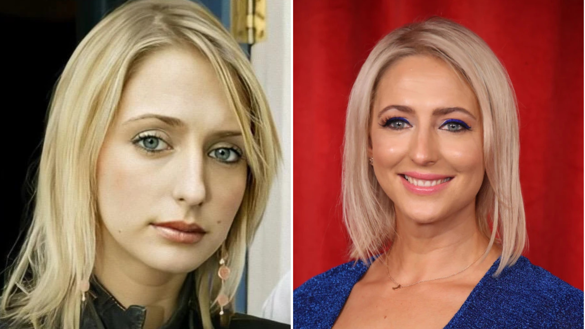 Hollyoaks Star Ali Bastian Diagnosed With Breast Cancer: 'It Hit Us Like A Sledgehammer'