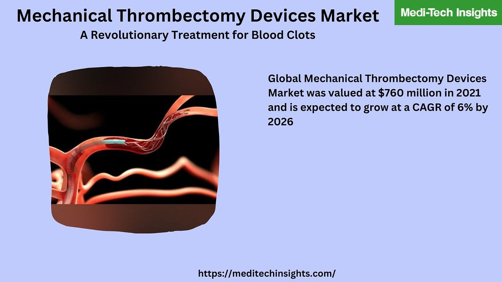 Mechanical Thrombectomy Devices Market to Reach USD XX Billion by 2031: InsightAce Analytic Report