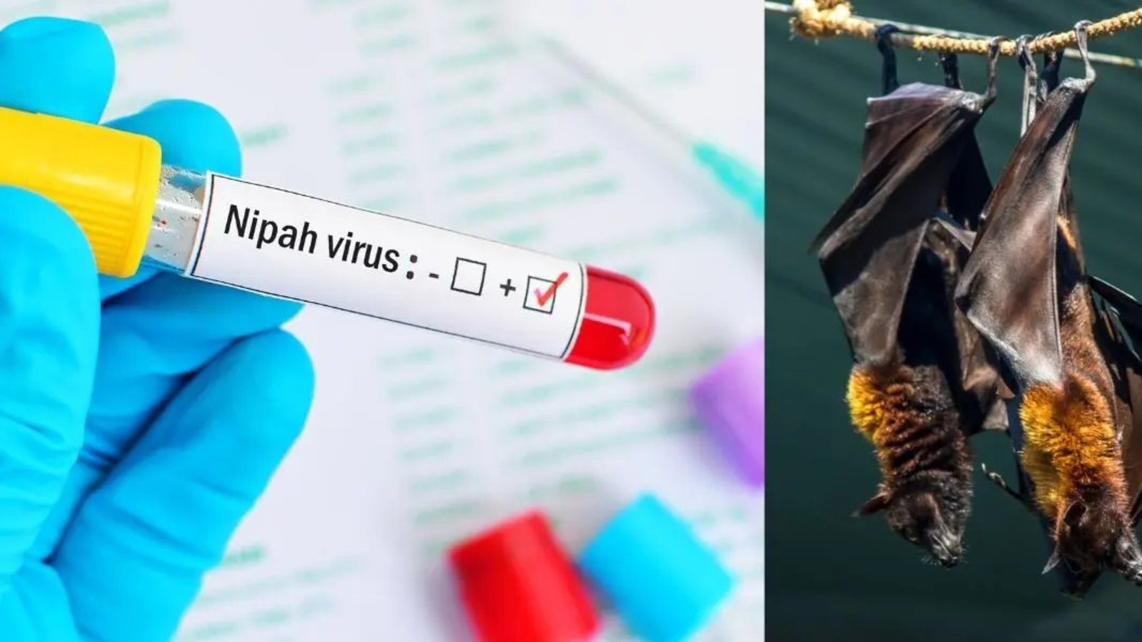 Nipah Virus: Kerala on High Alert as 24-Year-Old Student Dies, Over 150 People Under Observation