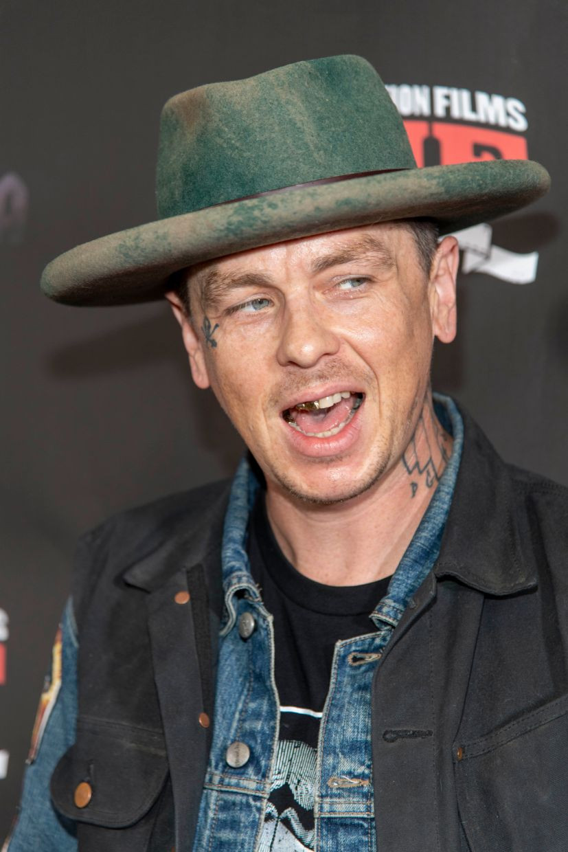 Slipknot's Sid Wilson Hospitalized After 'Explosion' at His Farm