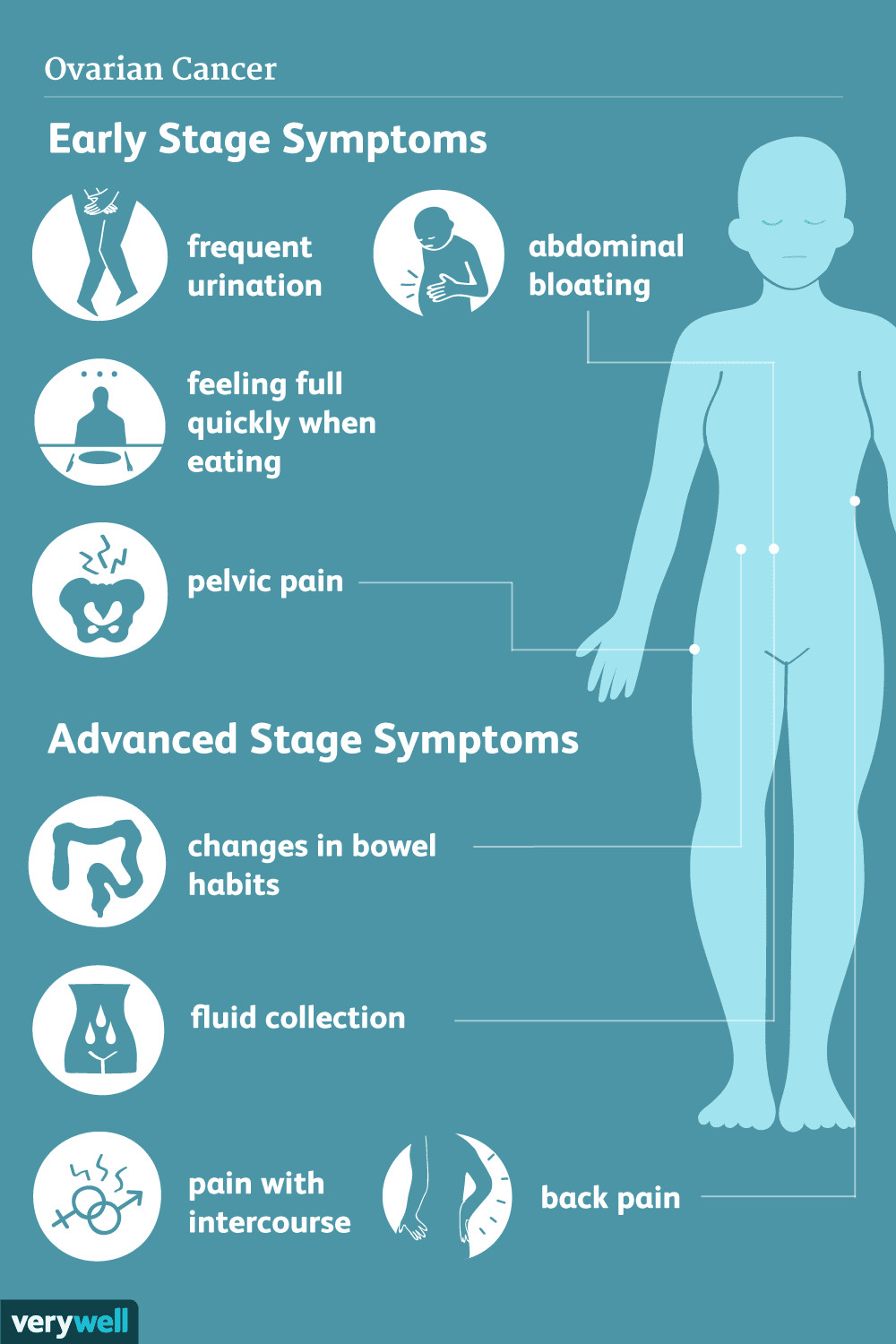 Symptom-Triggered Testing for Ovarian Cancer: Early Detection and Improved Outcomes